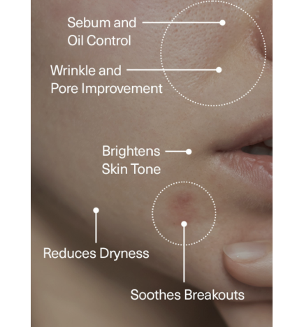 Сыворотка с ниацинамидом 15% и цинком FRANKY Niacinamide 15% + Zinc PCA Beads Serum (30 мл)