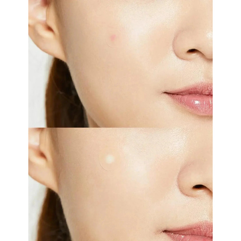 Plāksteri pret pūtītēm COSRX Acne Pimple Master Patch (24 gab.)