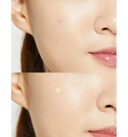 Plāksteri pret pūtītēm COSRX Acne Pimple Master Patch (24 gab.)